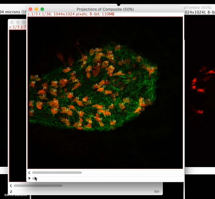 count cell manually imagej fiji